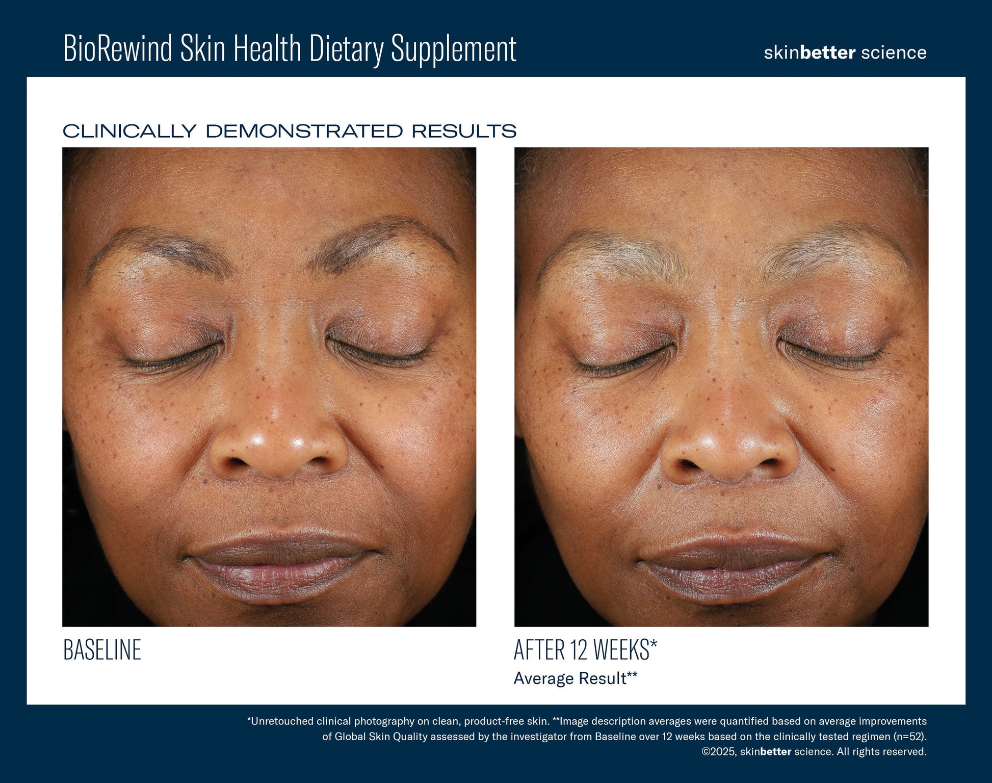 BioRewind Skin Health Dietary Supplement