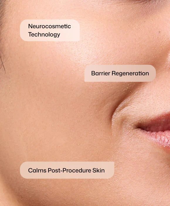 CMT Post-Procedure Cream