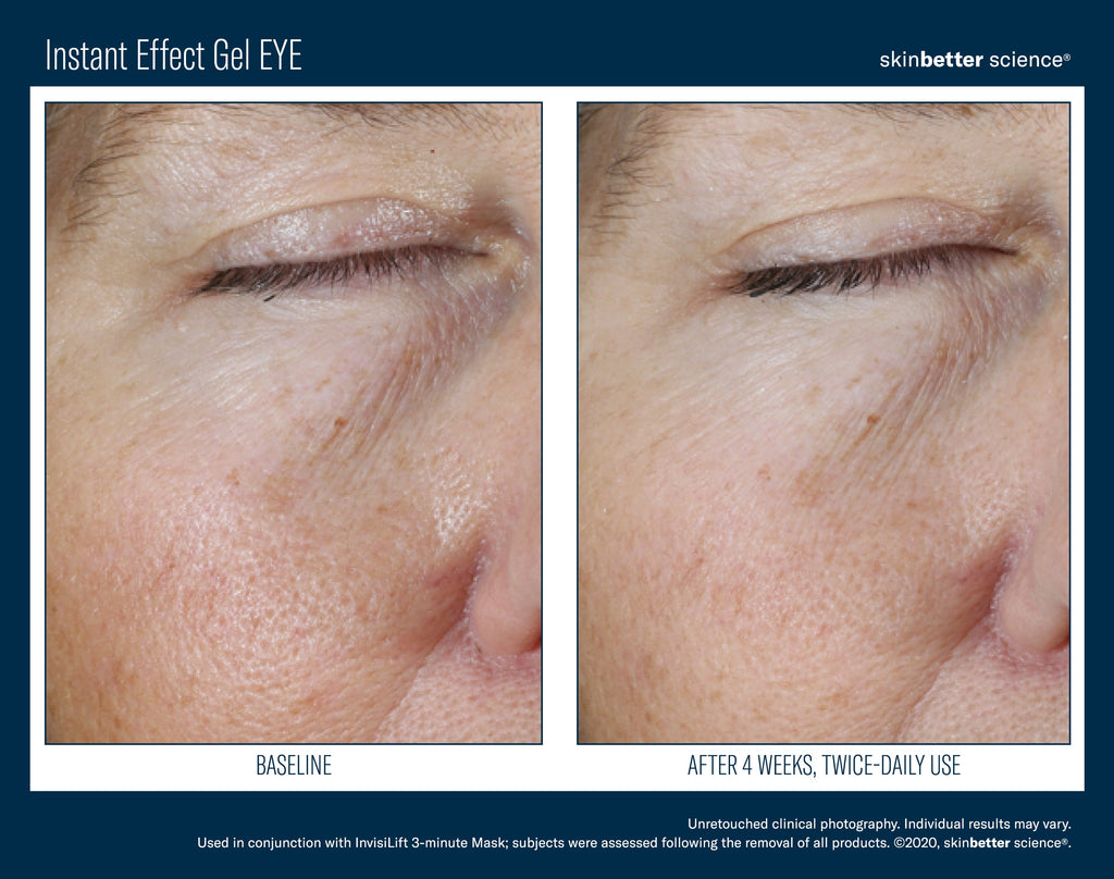 Instant Effect Gel EYE 15 ml