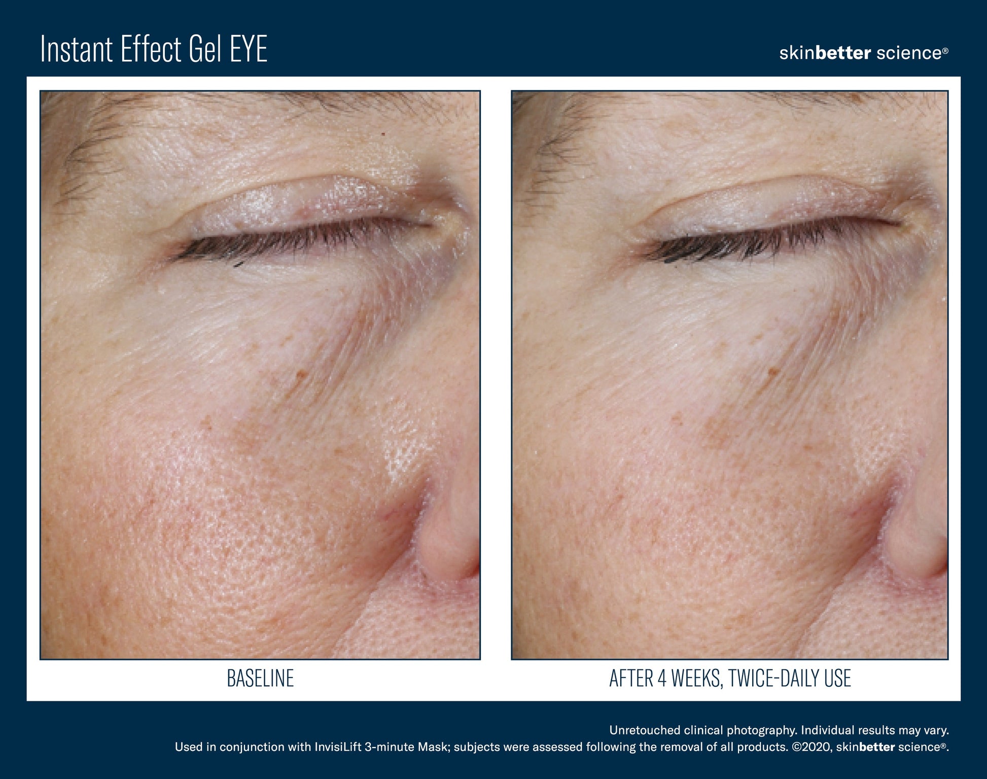 Instant Effect Gel EYE 15 ml