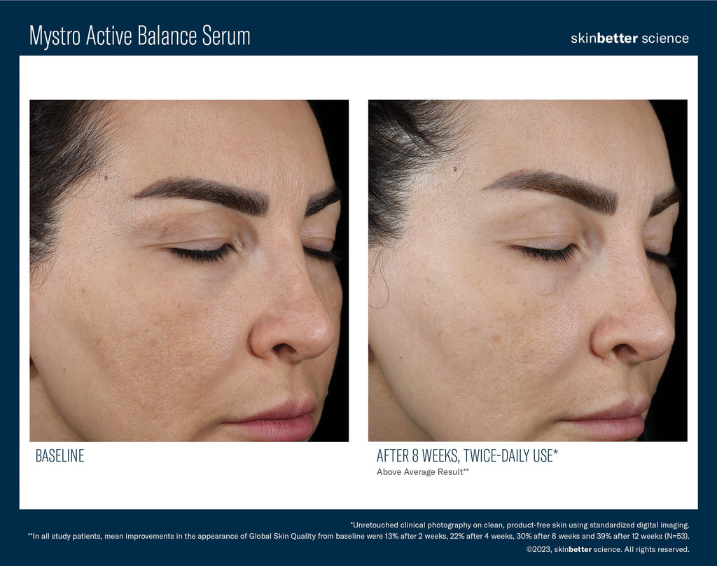 Mystro Active Balance Serum 30 ml