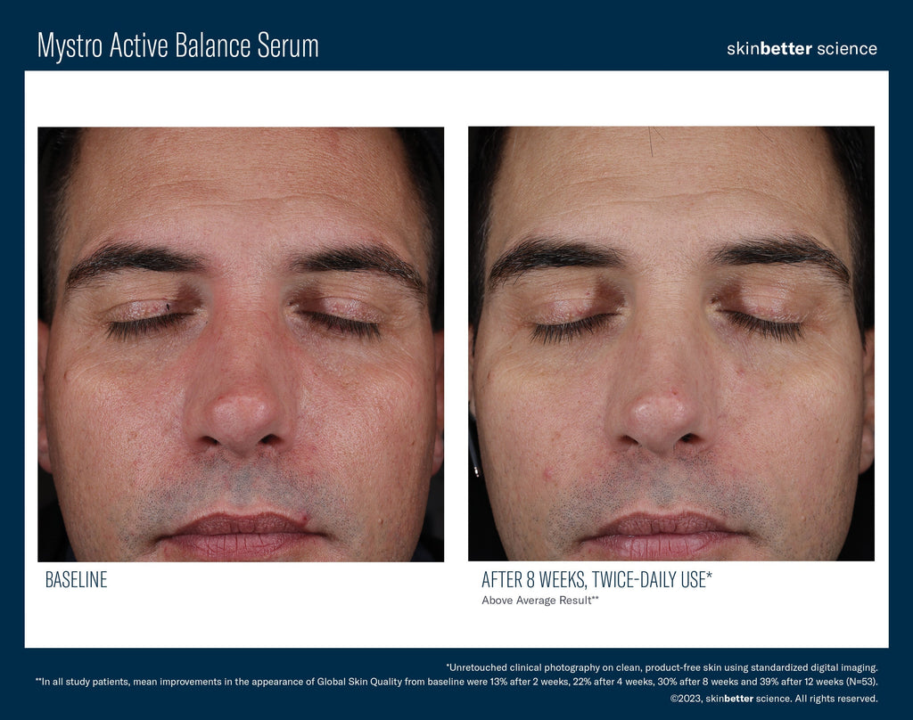 Mystro Active Balance Serum 30 ml