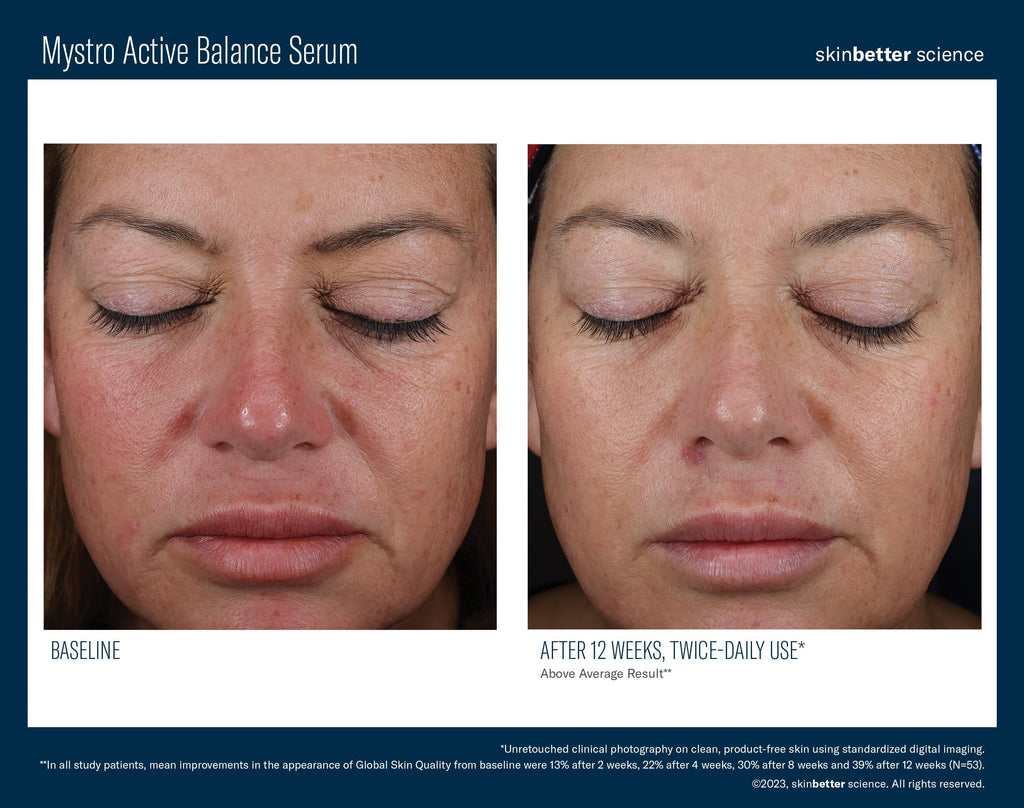 Mystro Active Balance Serum 30 ml