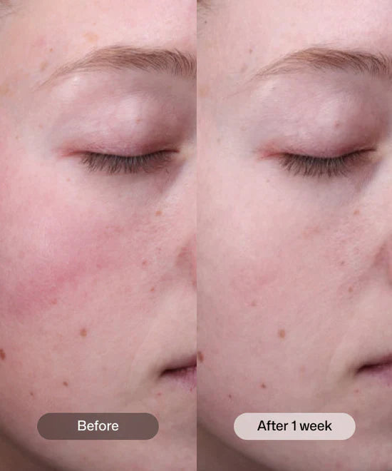 Radiance+ Resurfacing Serum 1 oz