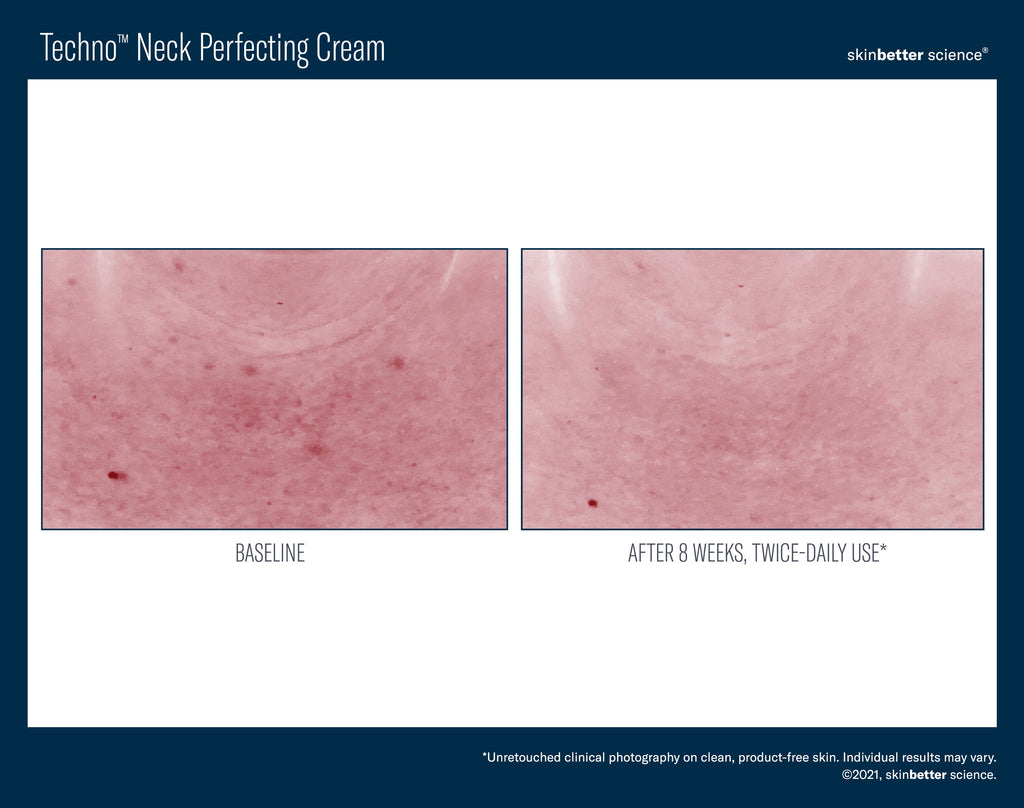 Techno Neck Perfecting Cream