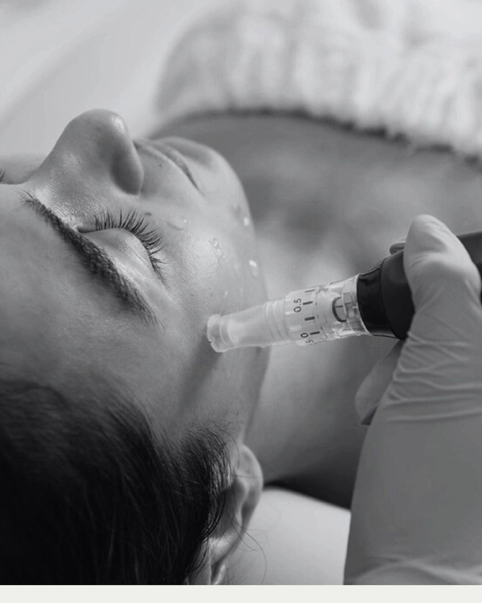 Skinpen Microneedling Package + Exosomes (3 pack)