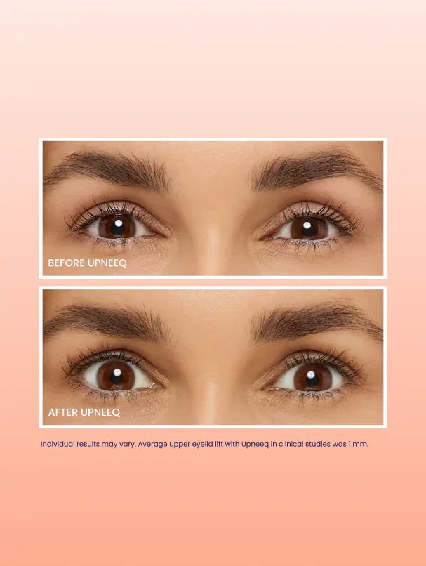 UPNEEQ Eye Drops 30 ct